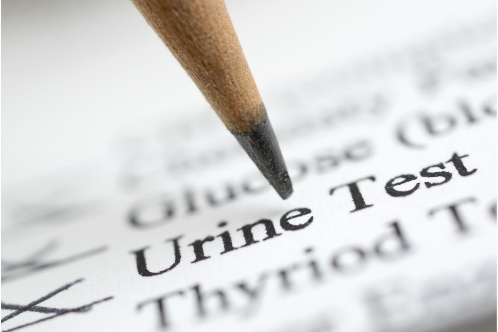 How Long Does LabCorp Take For Urine Results?